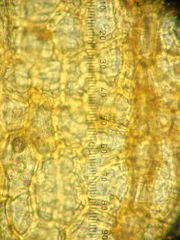 Photographie « Grimmia_alpestris_capsule_exothecium_TD » de l'espèce « Grimmia alpestris (F.Weber & D.Mohr) Schleich. »