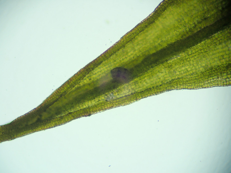 Photographie « Grimmia_alpestris_feuille_apex_TD » de l'espèce « Grimmia alpestris (F.Weber & D.Mohr) Schleich. »