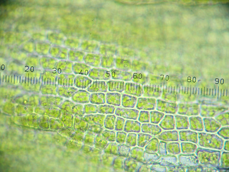 Photographie « Grimmia_alpestris_feuille_cellules_TD » de l'espèce « Grimmia alpestris (F.Weber & D.Mohr) Schleich. »
