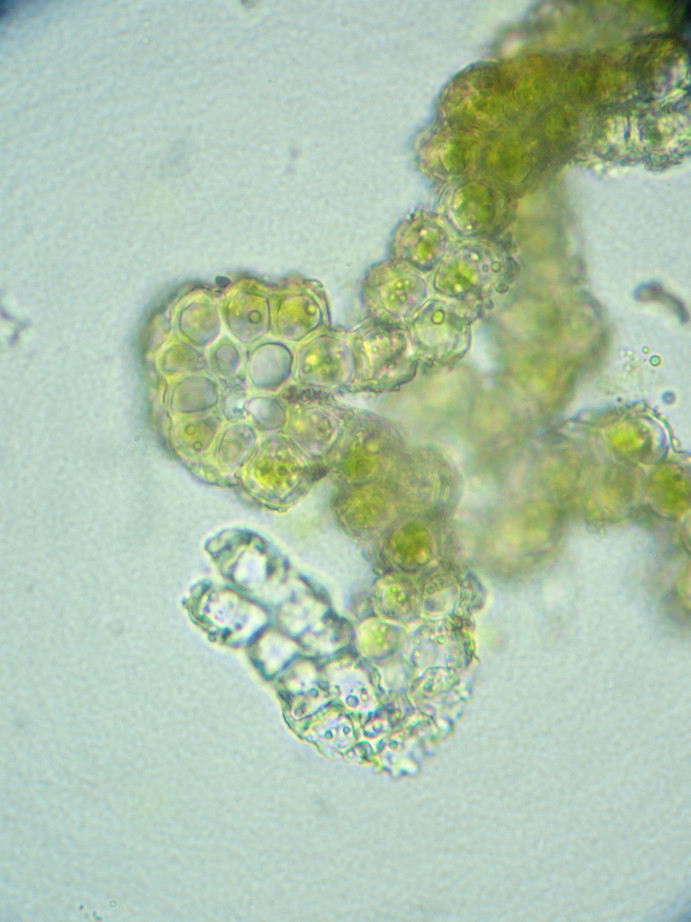Photographie « Grimmia_alpestris_feuille_CT2_TD » de l'espèce « Grimmia alpestris (F.Weber & D.Mohr) Schleich. »