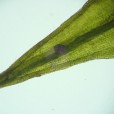 Miniature « Grimmia_alpestris_feuille_apex_TD » de l'espèce « Grimmia alpestris (F.Weber & D.Mohr) Schleich. »