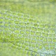 Miniature « Grimmia_alpestris_feuille_cellules_TD » de l'espèce « Grimmia alpestris (F.Weber & D.Mohr) Schleich. »