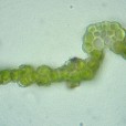 Miniature « Grimmia_alpestris_feuille_CT1_TD » de l'espèce « Grimmia alpestris (F.Weber & D.Mohr) Schleich. »